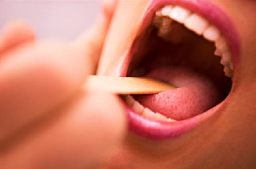 ประเภทของปรสิตในปากของมนุษย์